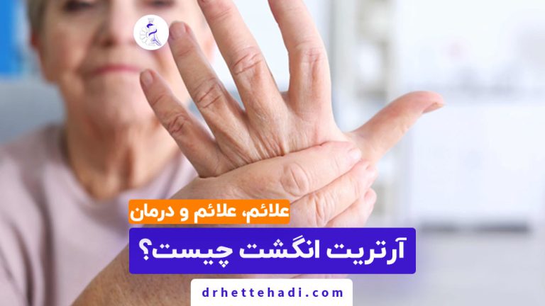 آرتریت انگشت چیست