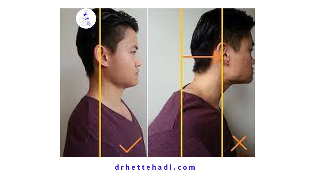 بهبود درد گردن-حفظ وضعیت تعادلی